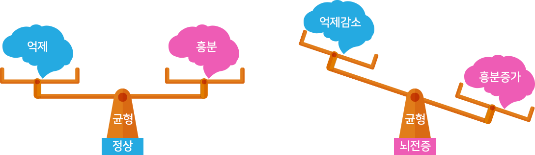 뇌전증이란?